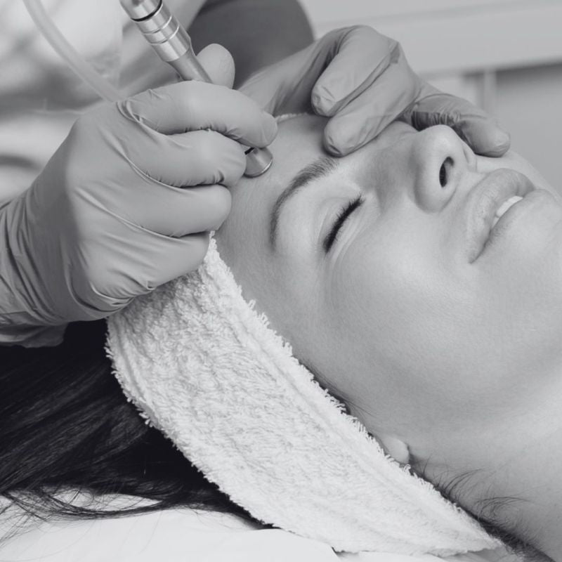 Microdermabrasion