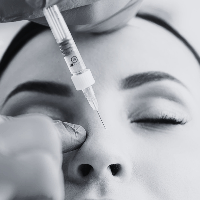 non-surgical rhinoplasty