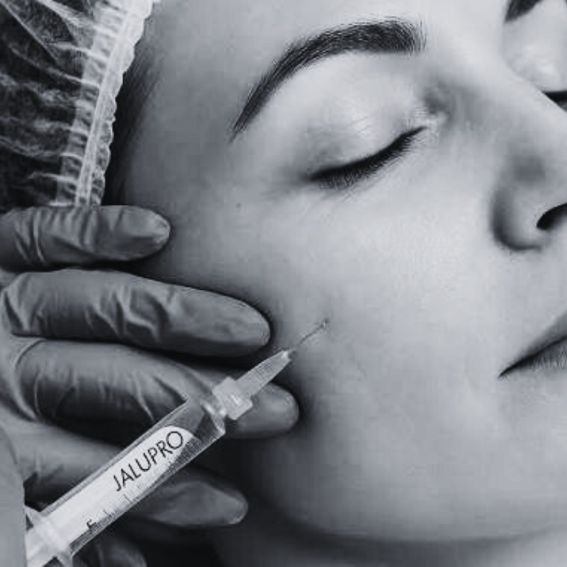 jalupro - skin boosters