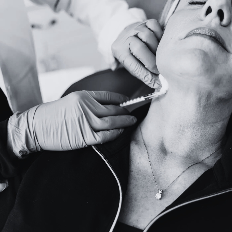 nefertiti neck lift