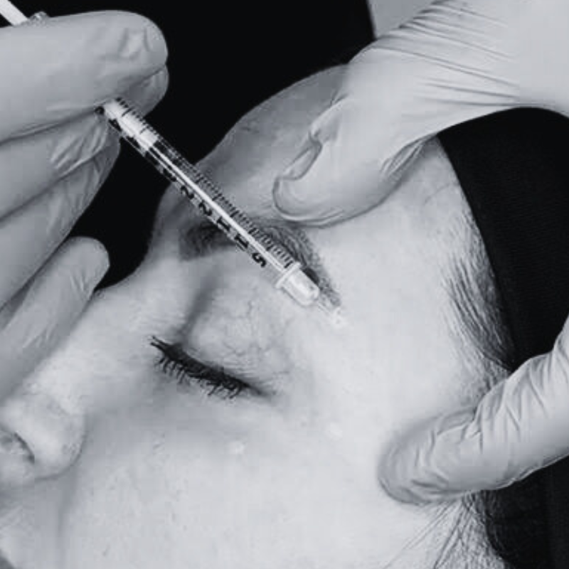 chemical brow lift