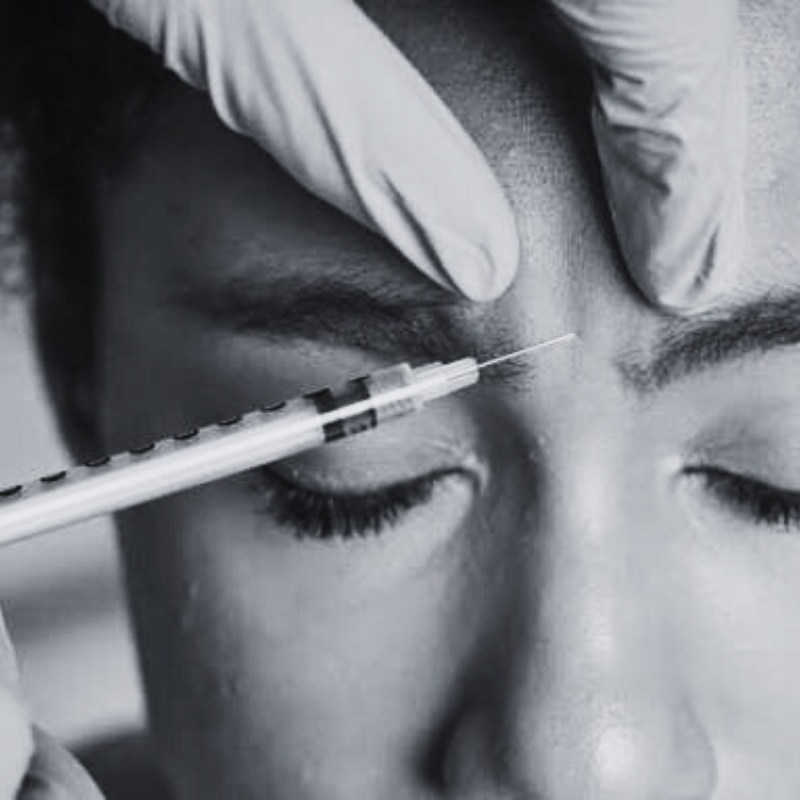 anti-wrinkle injections - 1, 2 or 3 areas
