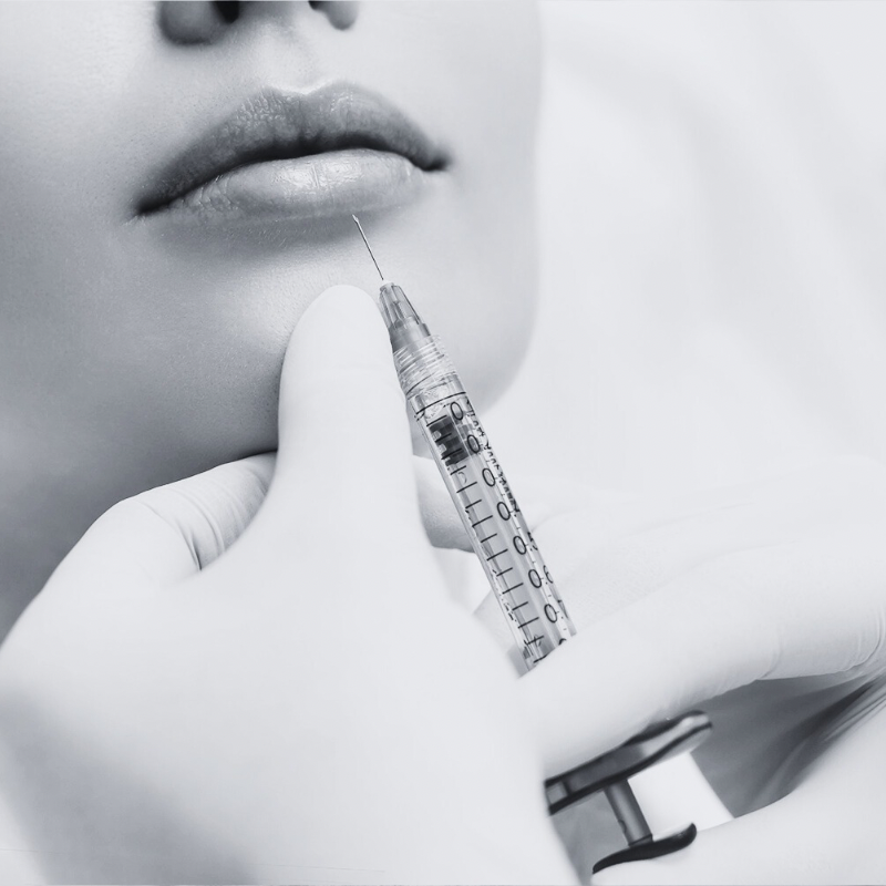 lip filler