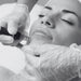 wolverhampton microneedling
